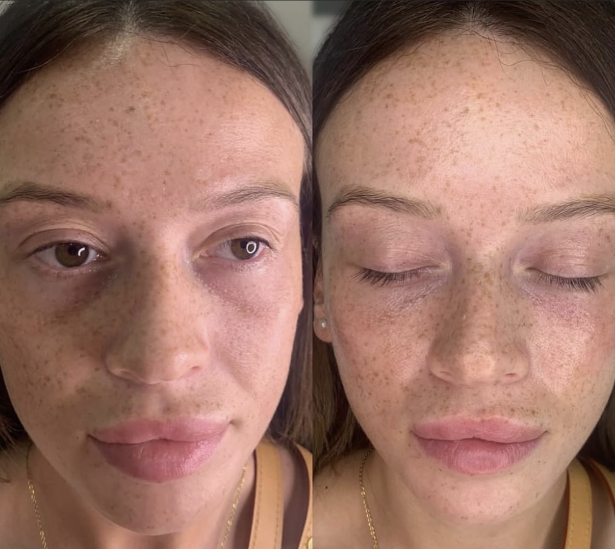 Natural enhancement result